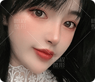 眼綜合手術